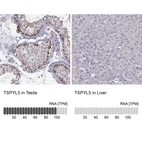 Anti-TSPYL5 Antibody