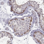 Immunohistochemical staining of human testis shows strong cytoplasmic positivity in spermatogonia.