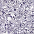 Immunohistochemical staining of human placenta shows no positivity in trophoblastic cells as expected.