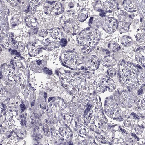 Anti-TSPYL5 Antibody