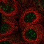 Immunofluorescent staining of human cell line A-431 shows localization to nucleoli.