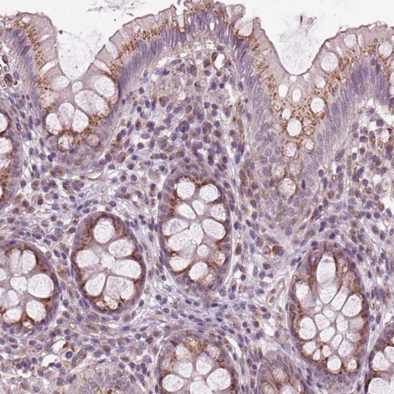 Anti-BSDC1 Antibody