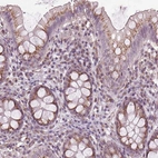 Anti-BSDC1 Antibody