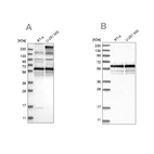 Western blot analysis using Anti-BSDC1 antibody HPA031358 (A) shows similar pattern to independent antibody HPA031360 (B).