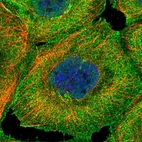 Immunofluorescent staining of human cell line A-431 shows localization to plasma membrane & the Golgi apparatus.