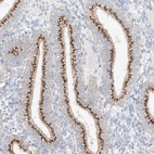 Anti-BSDC1 Antibody