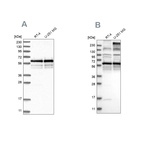 Western blot analysis using Anti-BSDC1 antibody HPA031360 (A) shows similar pattern to independent antibody HPA031358 (B).
