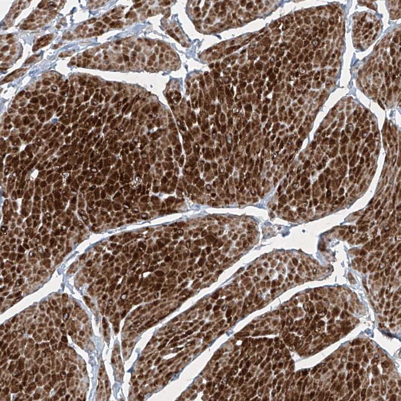 Anti-PPCS Antibody