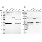 Western blot analysis using Anti-PPCS antibody HPA031361 (A) shows similar pattern to independent antibody HPA031363 (B).