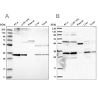 Western blot analysis using Anti-PPCS antibody HPA031361 (A) shows similar pattern to independent antibody HPA031363 (B).