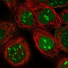 Immunofluorescent staining of human cell line A-431 shows localization to nucleus & nucleoli fibrillar center.