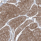 Anti-PPCS Antibody