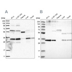 Western blot analysis using Anti-PPCS antibody HPA031363 (A) shows similar pattern to independent antibody HPA031361 (B).