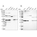 Western blot analysis using Anti-PPCS antibody HPA031363 (A) shows similar pattern to independent antibody HPA031361 (B).
