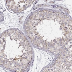 Immunohistochemical staining of human testis shows high expression.