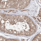 Immunohistochemical staining of human testis shows moderate cytoplasmic positivity in cells in seminiferous ducts.
