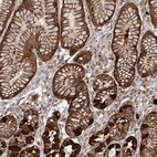Immunohistochemical staining of human stomach shows strong cytoplasmic positivity in glandular cells.