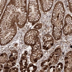 Immunohistochemical staining of human stomach shows strong cytoplasmic positivity in glandular cells.