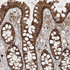 Immunohistochemical staining of human colon shows strong cytoplasmic positivity in glandular cells.