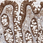 Immunohistochemical staining of human colon shows strong cytoplasmic positivity in glandular cells.