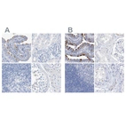 Immunohistochemical staining of human fallopian tube, kidney, lymph node and testis using Anti-C1orf87 antibody HPA031366 (A) shows similar protein distribution across tissues to independent antibody HPA031368 (B).