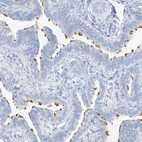 Immunohistochemical staining of human fallopian tube shows high expression.