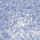 Anti-C1orf87 Antibody