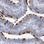 Immunohistochemical staining of human fallopian tube using Anti-C1orf87 antibody HPA031368.