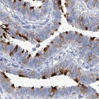 Immunohistochemical staining of human fallopian tube using Anti-C1orf87 antibody HPA031368.