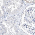 Immunohistochemical staining of human kidney using Anti-C1orf87 antibody HPA031368.