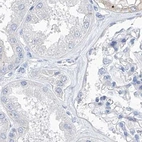 Immunohistochemical staining of human kidney using Anti-C1orf87 antibody HPA031368.