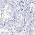 Immunohistochemical staining of human testis using Anti-C1orf87 antibody HPA031368.