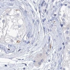Immunohistochemical staining of human testis using Anti-C1orf87 antibody HPA031368.