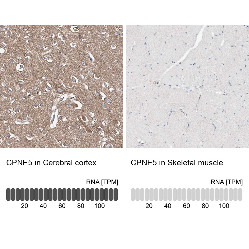Anti-CPNE5 Antibody