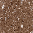 Immunohistochemical staining of human caudate shows strong granular cytoplasmic positivity in neuronal cells.
