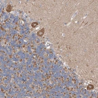 Immunohistochemical staining of human cerebellum shows moderate granular cytoplasmic positivity in Purkinje cells.