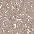 Immunohistochemical staining of human cerebral cortex shows moderate granular cytoplasmic positivity in neuronal cells and neuropil.