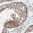 Immunohistochemical staining of human testis shows strong granular cytoplasmic positivity in cells in seminiferous ducts.