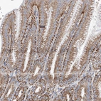 Immunohistochemical staining of human stomach shows moderate granular cytoplasmic positivity in glandular cells.