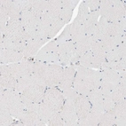 Immunohistochemical staining of human skeletal muscle shows no granular cytoplasmic positivity in myocytes as expected.