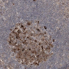 Immunohistochemical staining of human lymph node shows moderate to strong cytoplasmic positivity in germinal center cells.