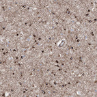 Immunohistochemical staining of human cerebral cortex shows strong cytoplasmic positivity in glial cells.