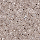 Immunohistochemical staining of human cerebral cortex shows strong cytoplasmic positivity in glial cells.