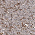 Immunohistochemical staining of human pancreas shows weak to moderate positivity in intercalated ducts