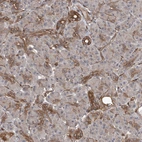 Immunohistochemical staining of human pancreas shows weak to moderate positivity in intercalated ducts