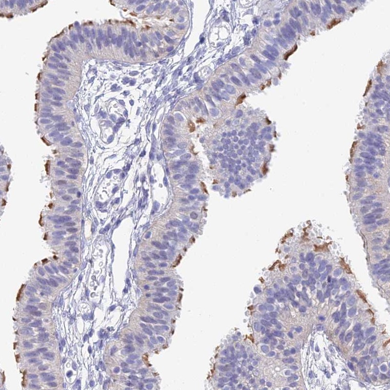Anti-DNAH14 Antibody