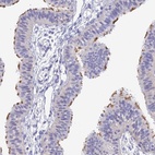 Anti-DNAH14 Antibody