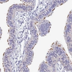 Anti-DNAH14 Antibody