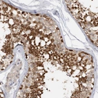 Immunohistochemical staining of human testis shows high expression.