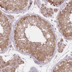 Immunohistochemical staining of human Testis shows moderate cytoplasmic positivity in cells in seminiferous ducts.